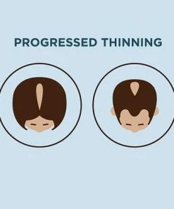 NIOXIN System 2 Scalp & Hair Treatment